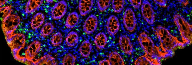 Secondary Antibodies