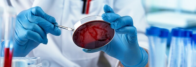 Microbiology