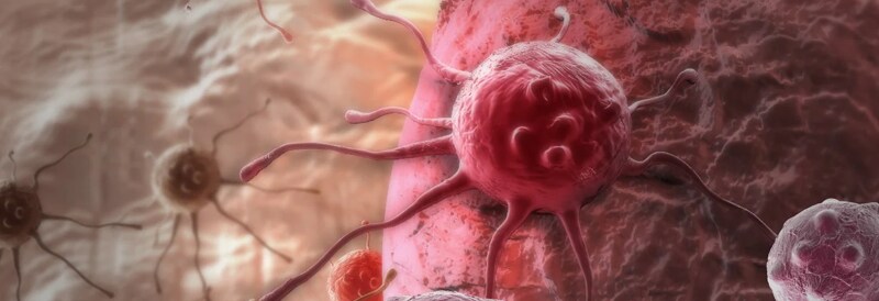 Making Cancer History - CAR T-Cell Therapy